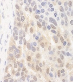 SPATA2 Antibody, Novus Biologicals 0.1mL; Unlabeled:Antibodies, Polyclonal